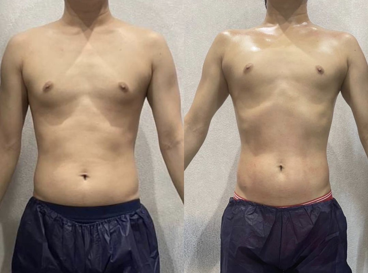 CELL BALANCE ビフォーアフター 男性 正面