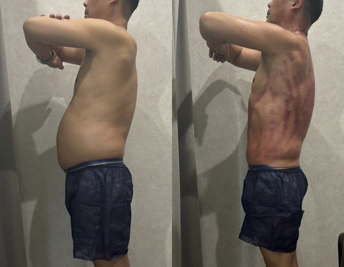 CELL BALANCE ビフォーアフター 男性 横